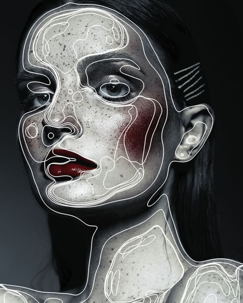 Line (5)