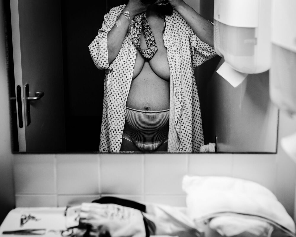 Before, After (3)