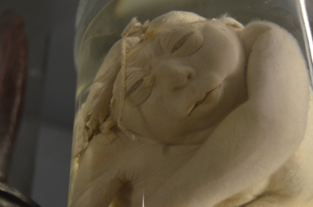 Photograph by Pierluigi Peis