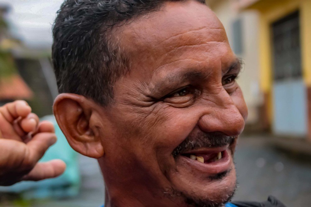 Um sorriso sem dentes