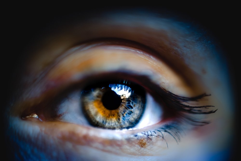 Гетерохромия