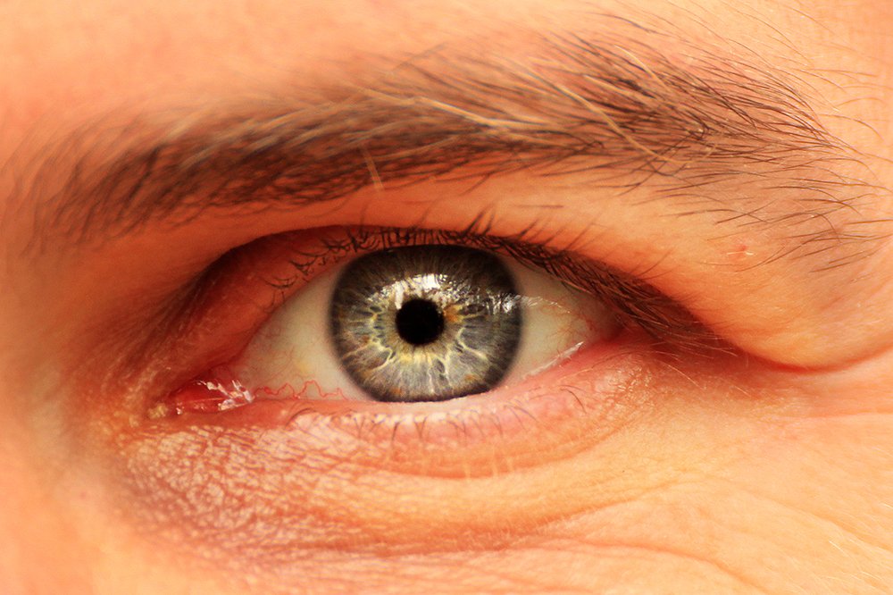 Eye