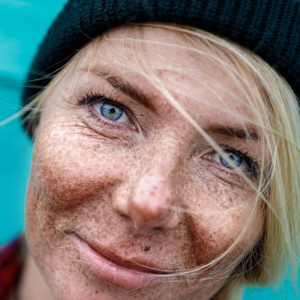 Веснушки Заполярья