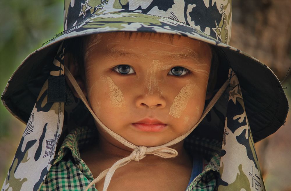 Children eye