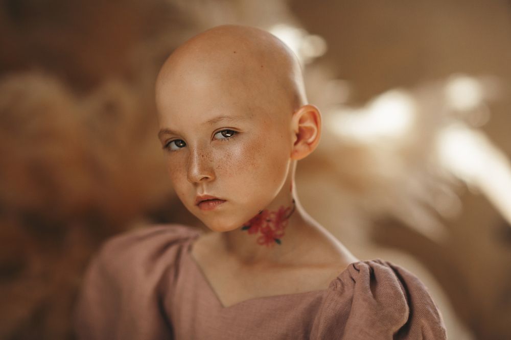 алопеция СЧАСТЬЕ БЫТЬ СОБОЙ