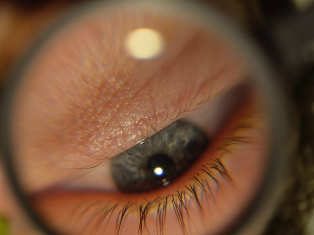 Photograph by Jozsef Cselenyi