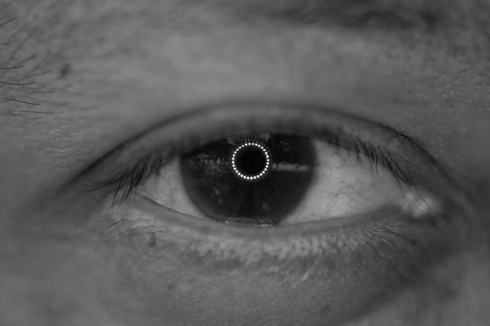 Eye Ring