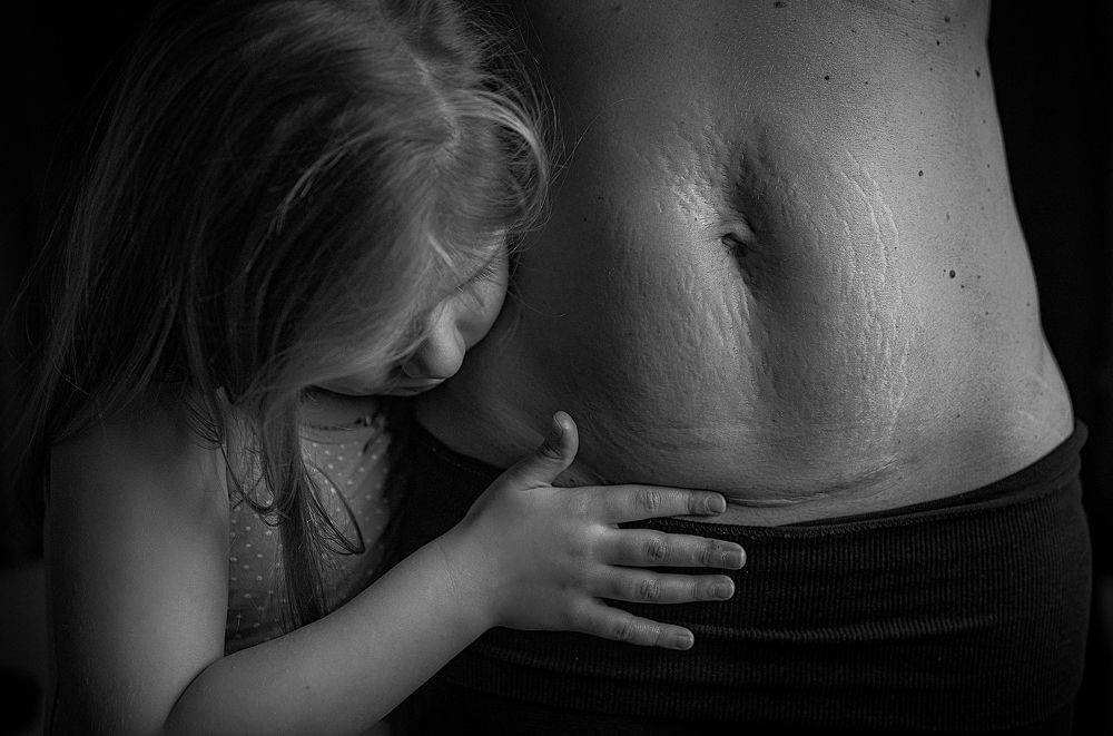 the most importent scars