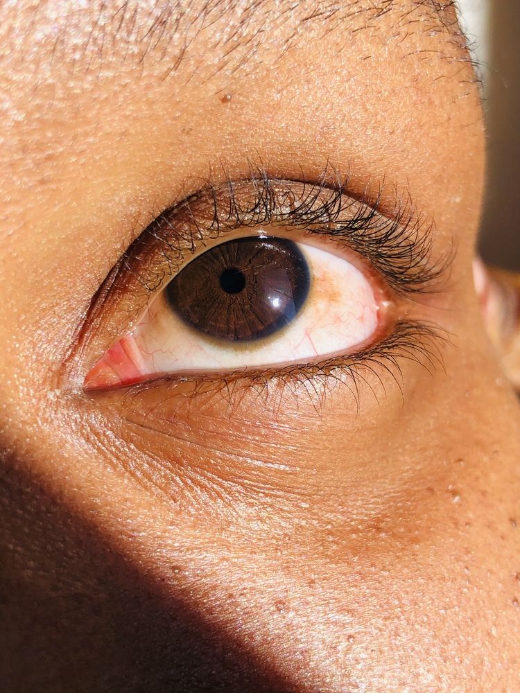 Photograph by Godfrey Banda