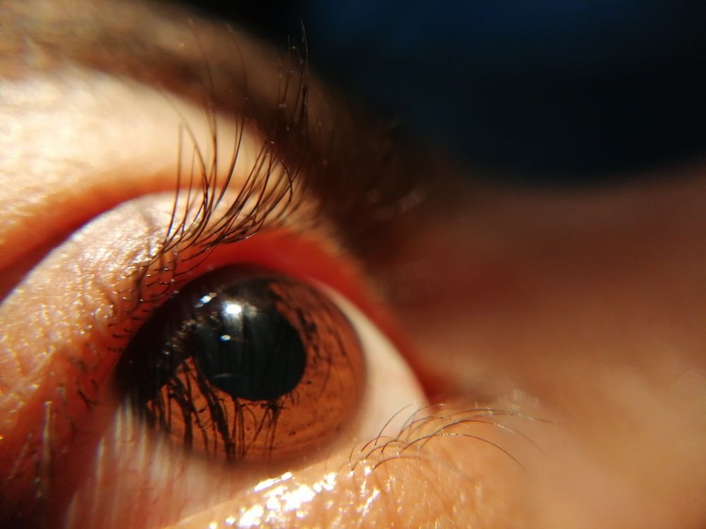 captured my own eye... captured on honor 8x