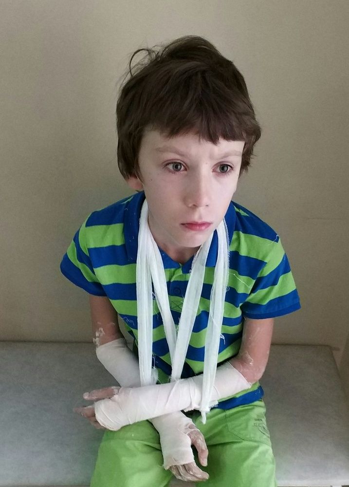 Почти не больно