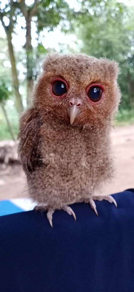 Eye