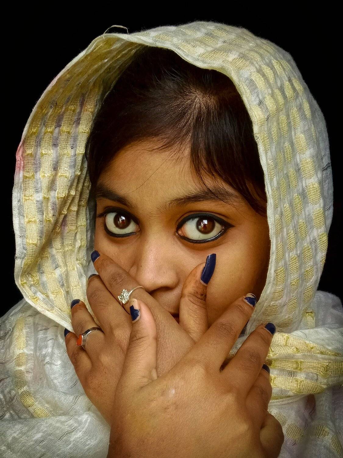 Avoid my scars because my eye contact is enough