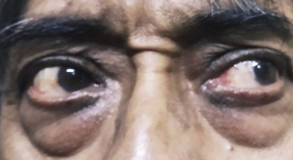 Photograph by  MD RIZWANULLAH SHUVO