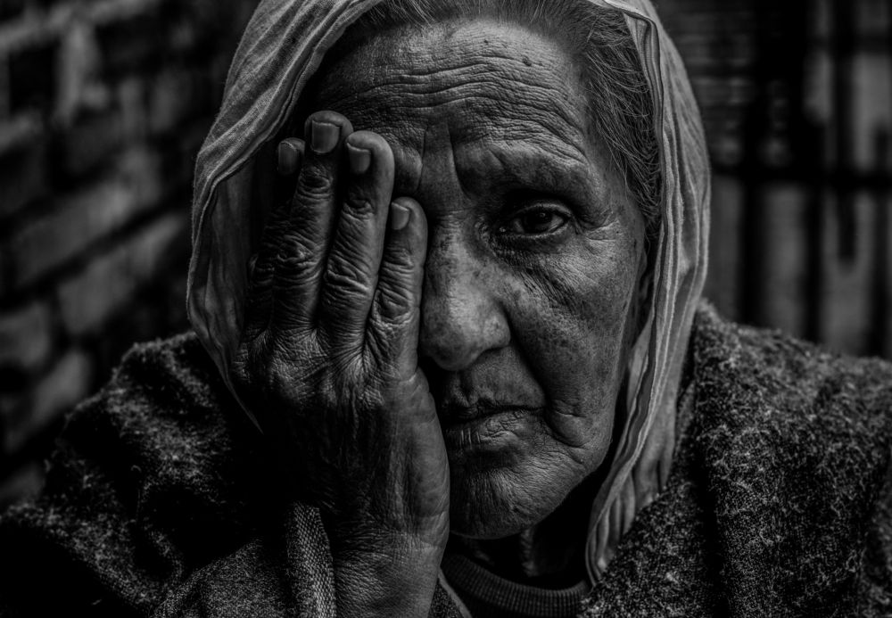 Fragility of age