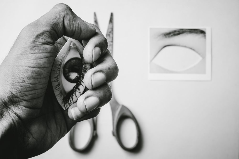 Black fungus infection in Kerala : Tirur man loses eye