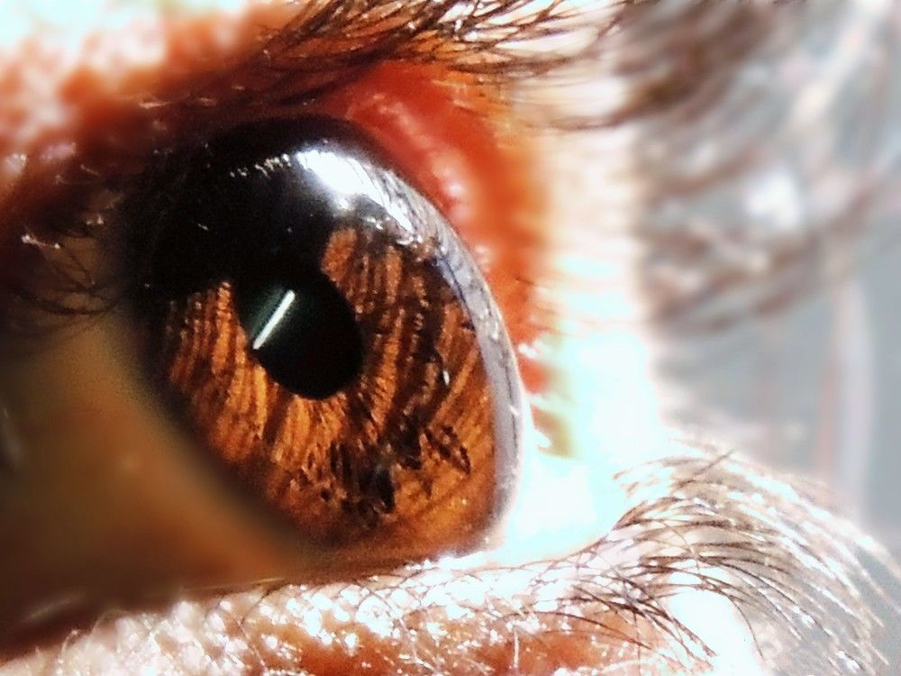 The window of the soul