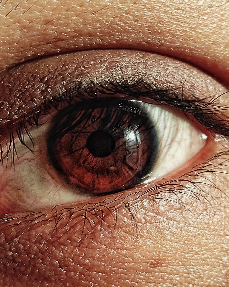 EYE