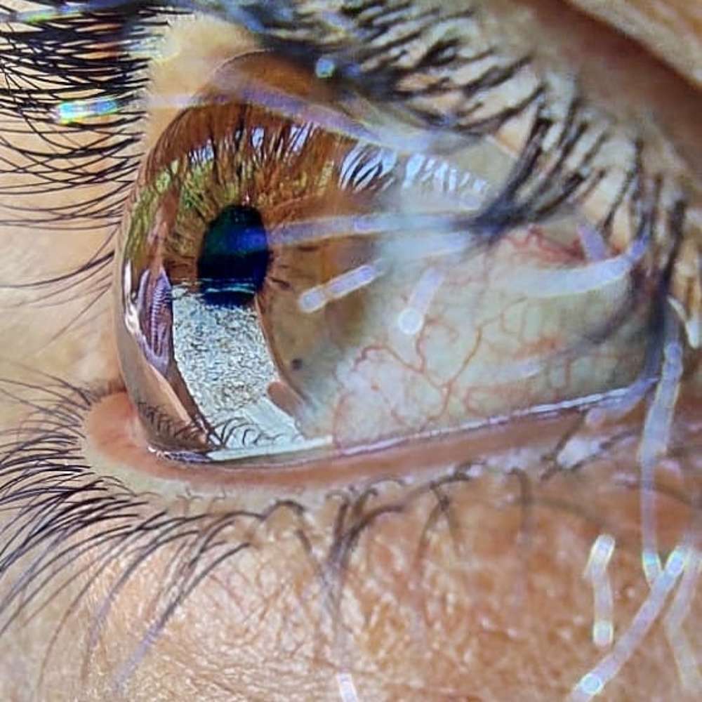 Human eye