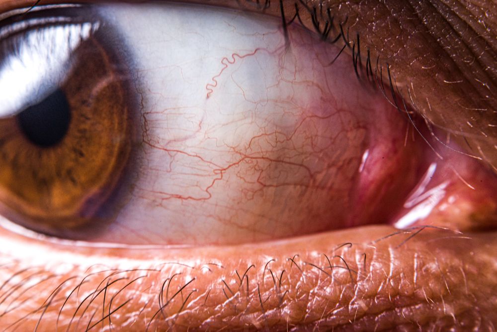 Reverse ring macro photography