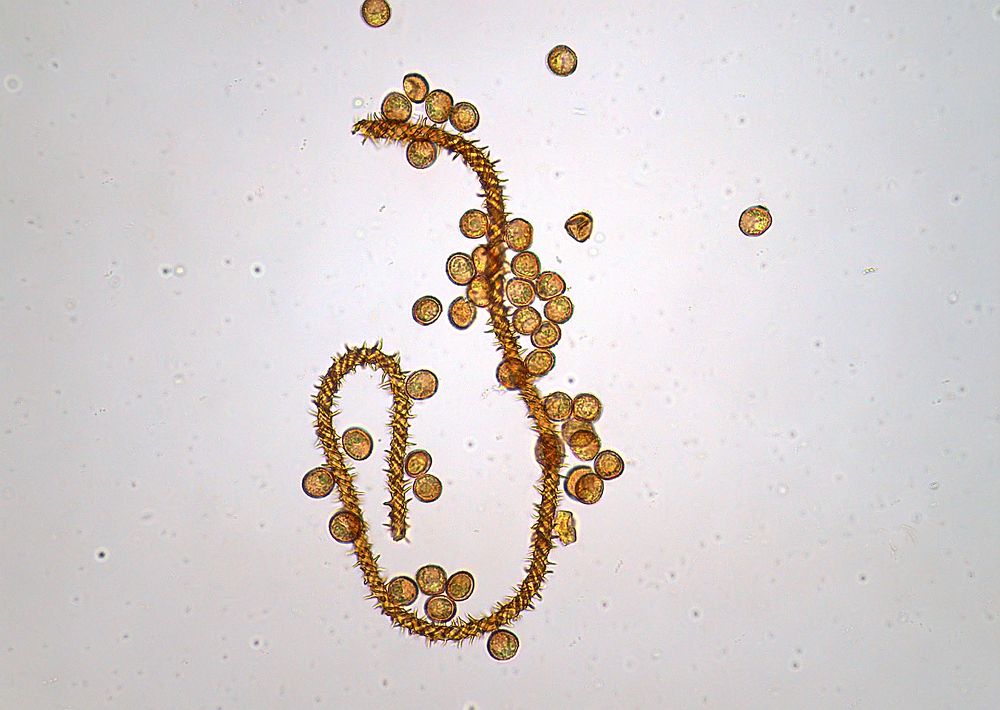Структуры спорофоров миксомицетов