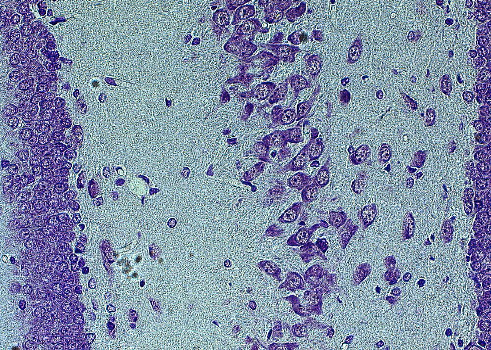 Пирамидные нейроны поля СА4 гиппокампа (справа) и гранулярные нейроны зубчатой фасции гиппокампа (слева)