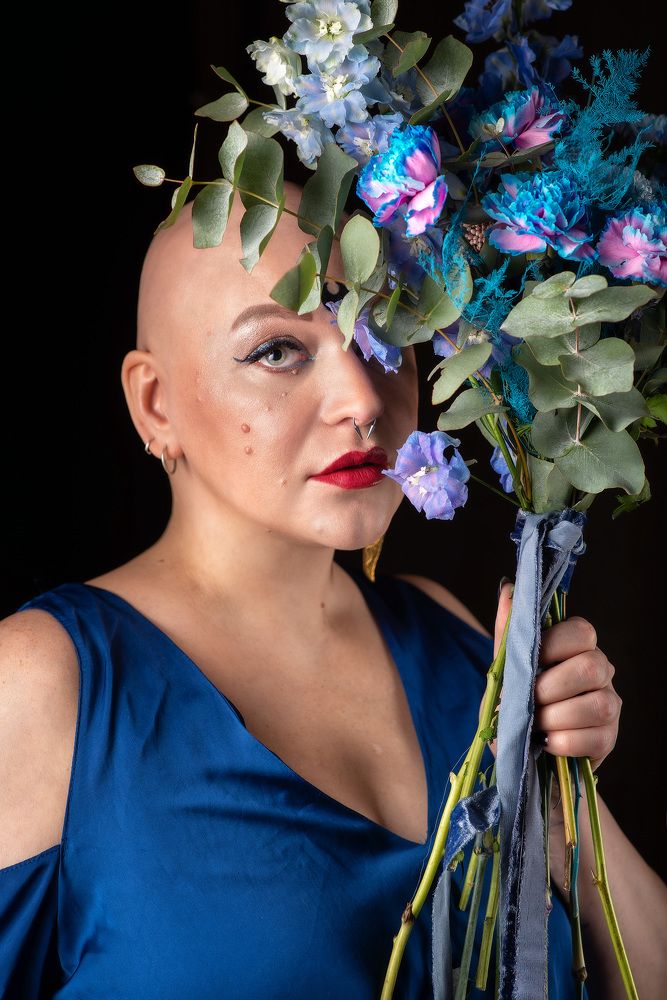 Алопеция не приговор!