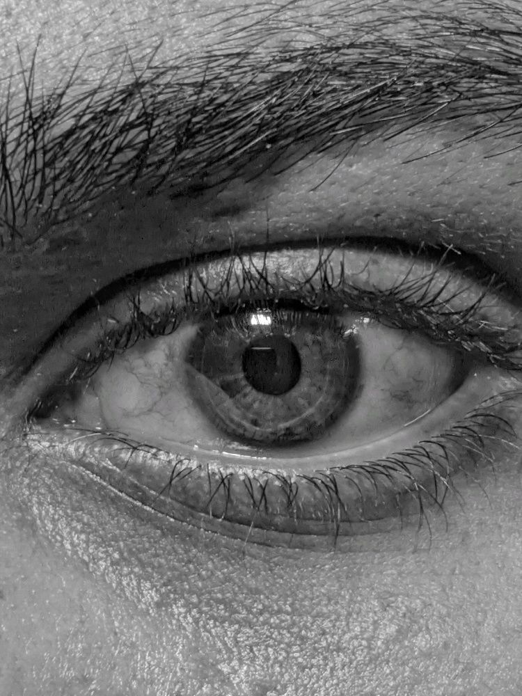 Eye