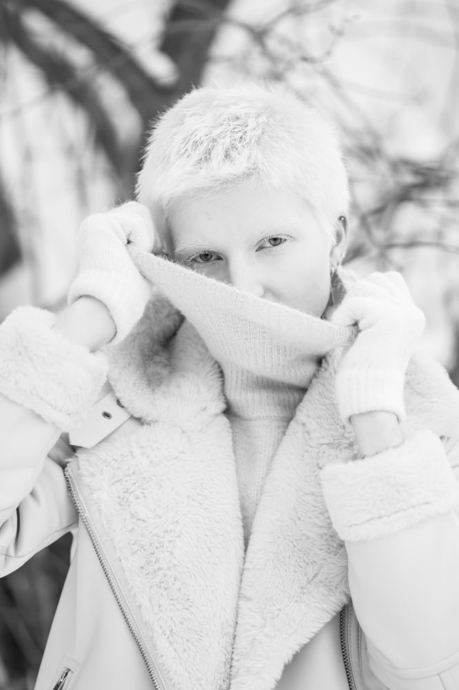 Девушка альбинос