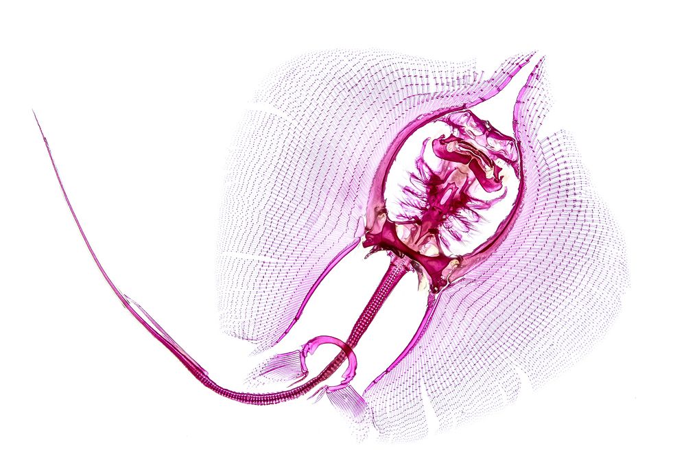 Diaphonized sting ray