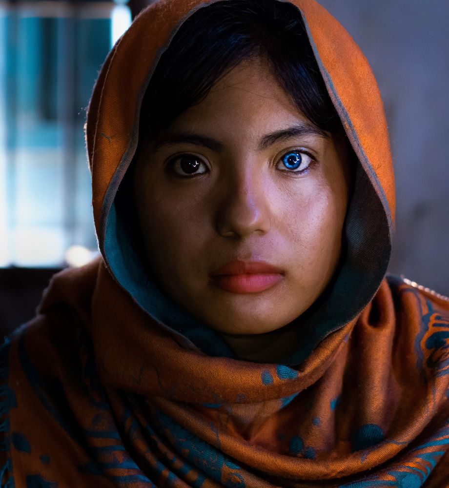 Portrait of a Cham ethnic girl with two colored eyes