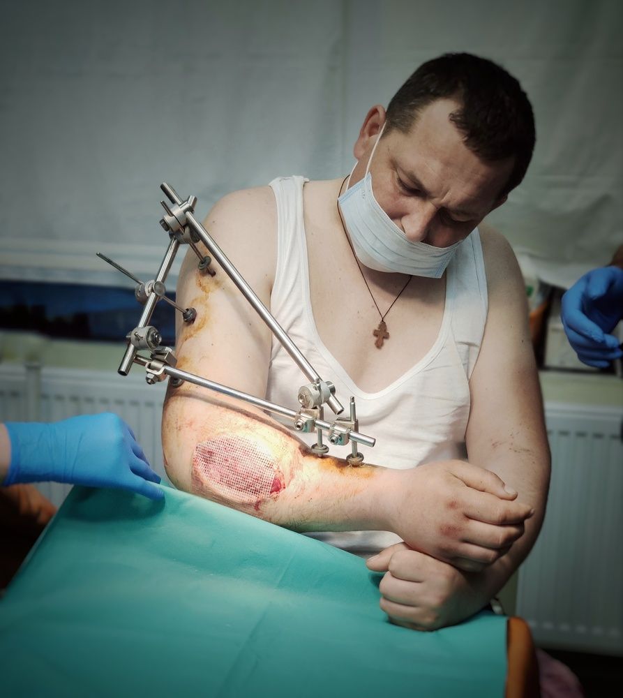 Витримка. Біль..Надія...