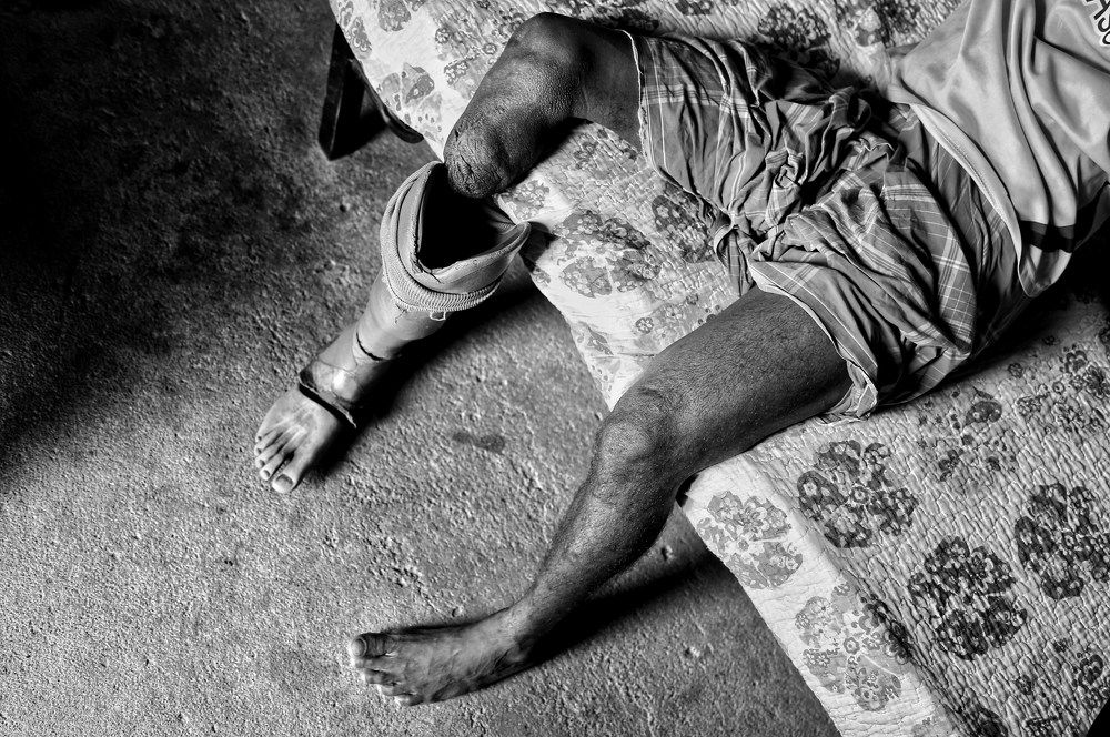 The scars of civil war