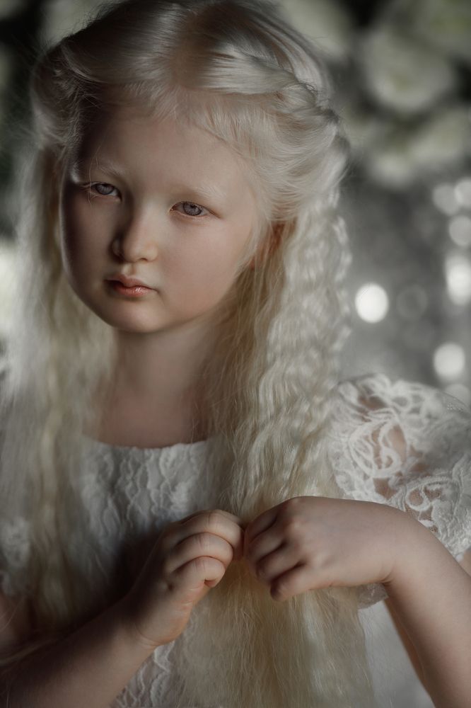 Девочка Альбинос