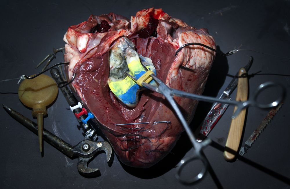 Извлечение