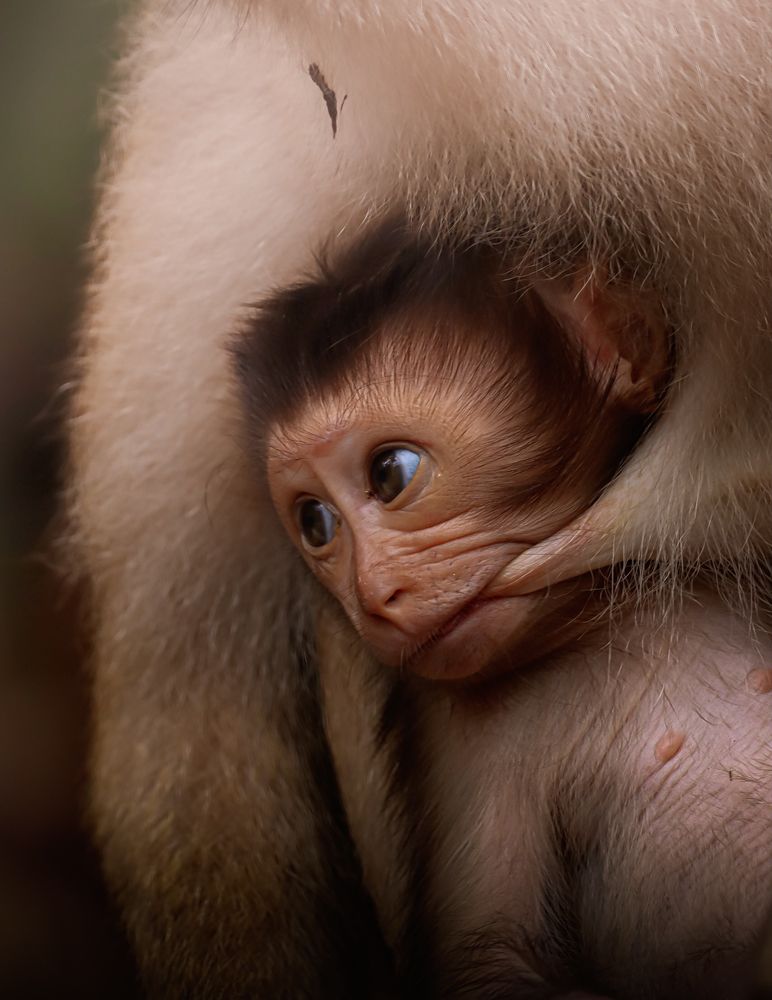 Painful breast feeding