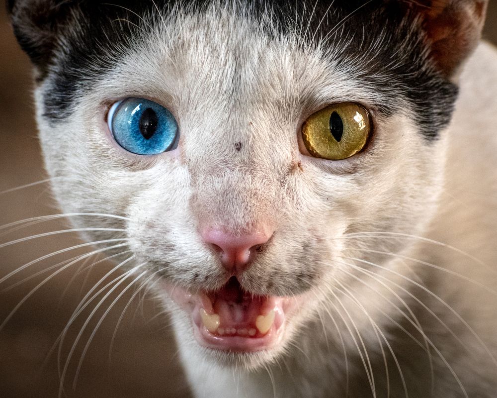 Heterochromia iridis