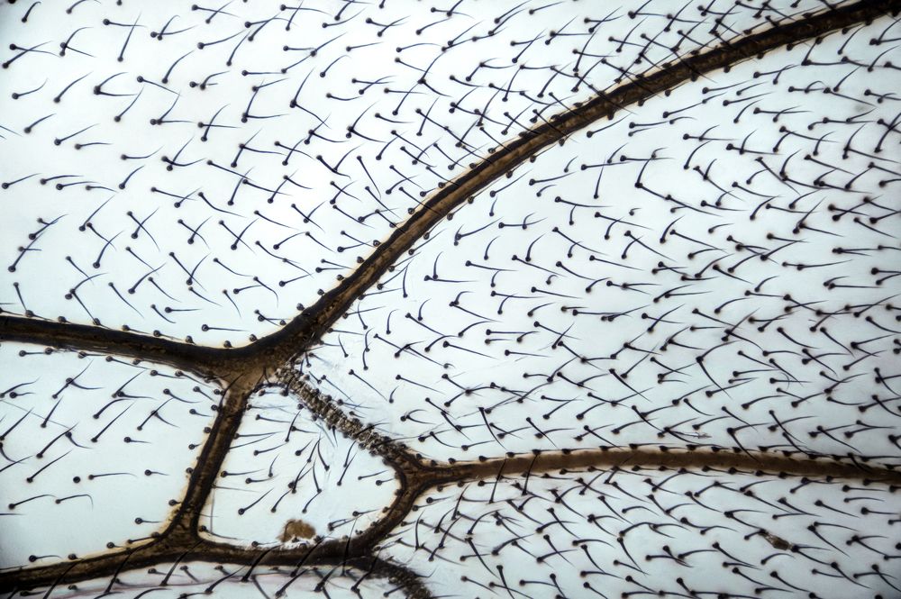 Needles of the Nature