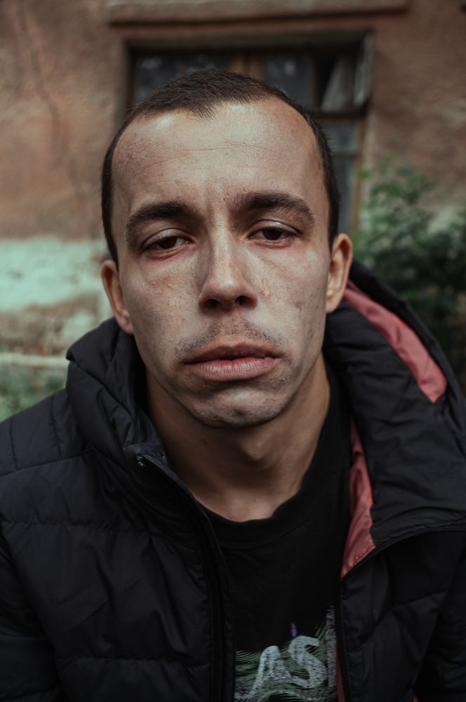 ЗАВИСИМОСТЬ - БОЛЕЗНЬ