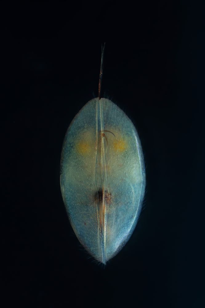 Ostracod