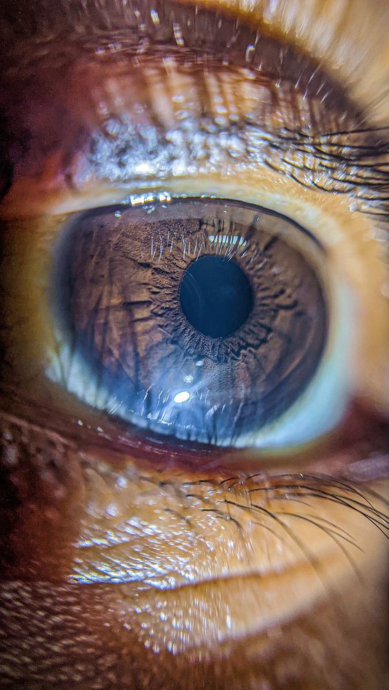'I see'