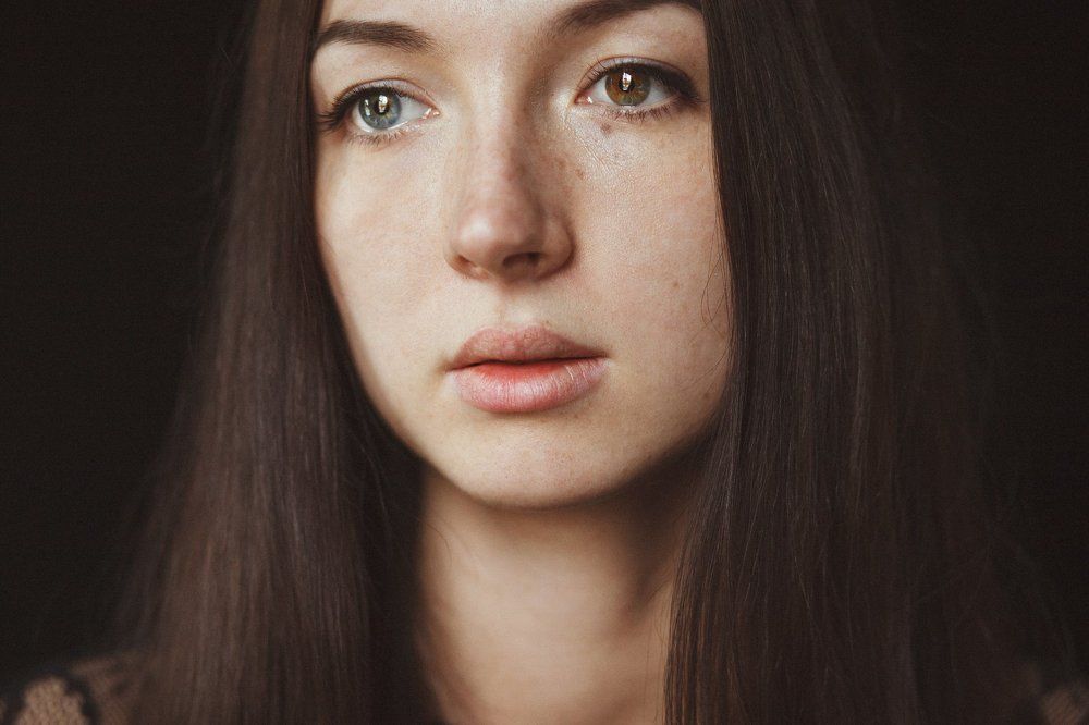 Heterochromia