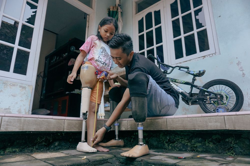 prosthetic leg maker