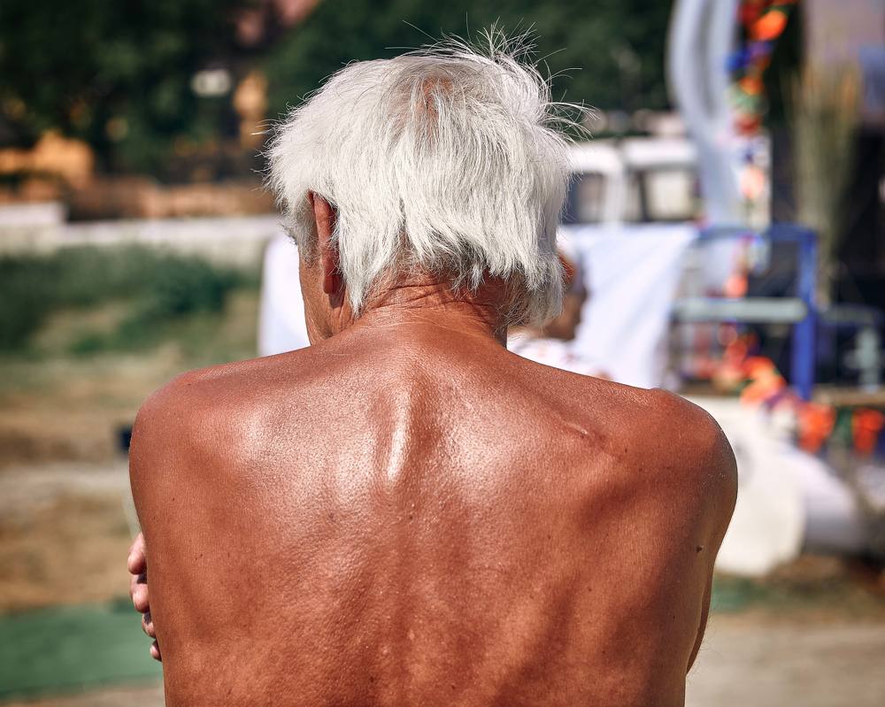 Вот это загар!