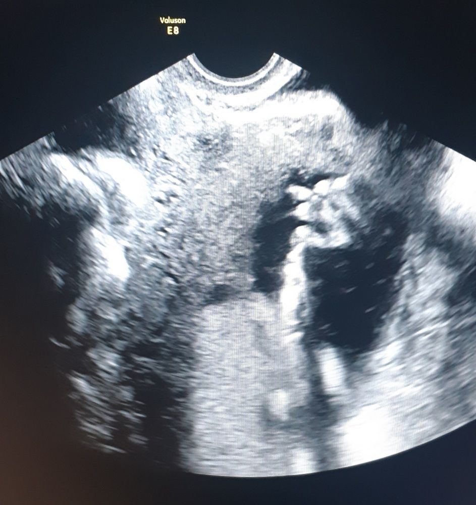 Photograph by Елена Ибрагимова