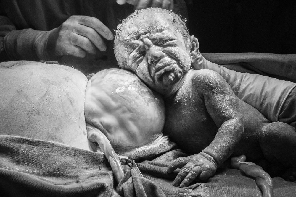 “Mamá de sostén a travez del cordón umbilical”