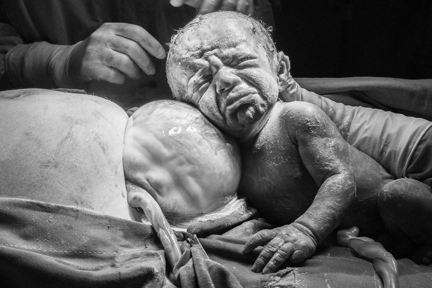 “Mamá de sostén a travez del cordón umbilical”