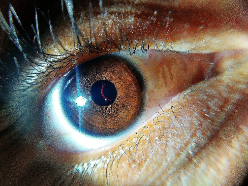 My eye