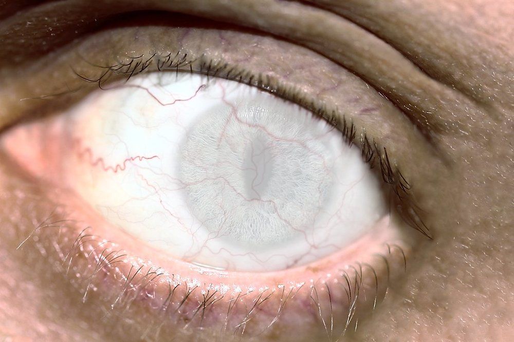 Зомби апокалипсис...