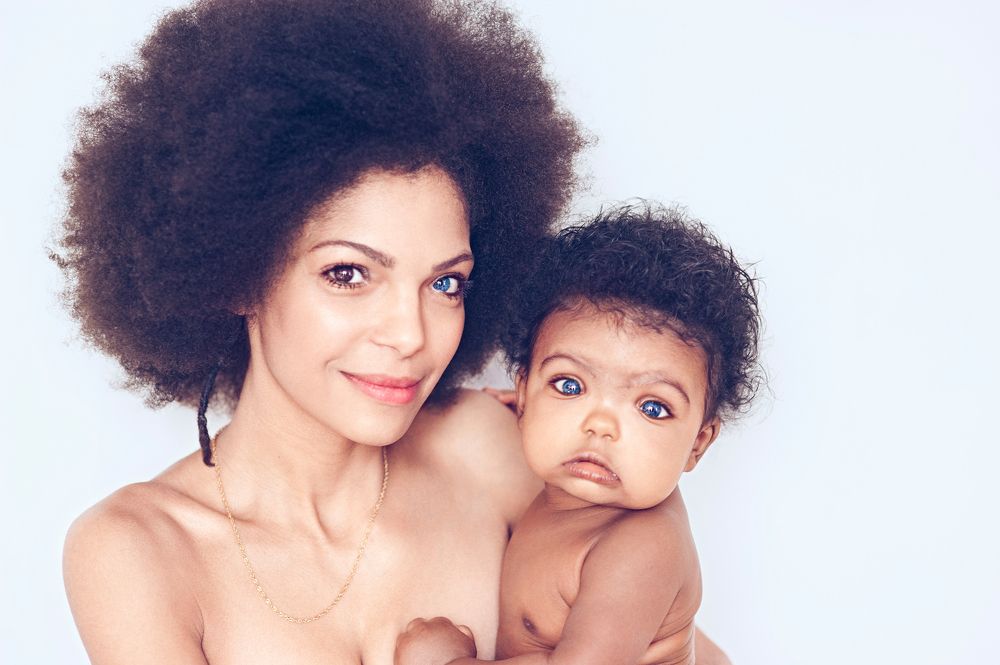 Heterocromia portrait